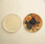 petri dish with mold, germs, bacteria and viruses